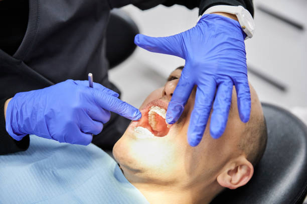 Best Emergency Treatment for Oral Infections in La Habra, CA